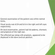 Image result for Orbital Hemorrhage CT