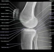 Image result for Lateral View of Knee Joint