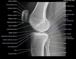 Image result for Lateral Knee Radiograph