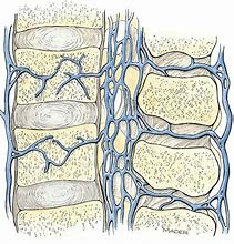 Image result for Venous Plexus Spine