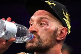 Image result for Tyson Fury SPAR Cut