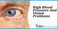 Image result for High Blood Pressure Eye Symptoms