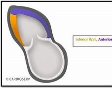 Image result for Rvit Echo View