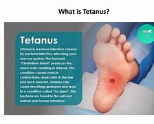 Image result for Tetanus Infected Wound