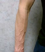 Image result for Veins On Forearm