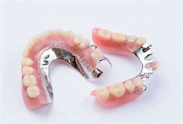 Image result for Partial Plate Dentures