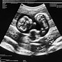 Image result for CT Baby Scan 3D