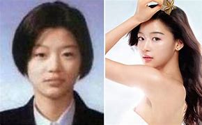 Image result for Jun Ji Hyun Plastic Surgery