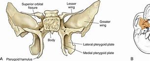 Image result for Pterygoid Plate