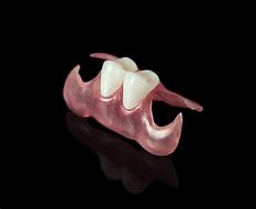 Image result for Valplast Partial One Tooth