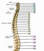 Image result for MYO-T12