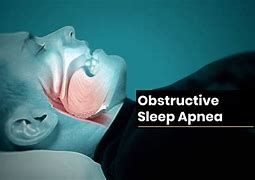 Image result for Obstructive Sleep Apnea Machine