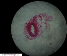 Image result for Ureter Histology Slides Labeled