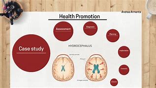 Image result for Hydrocephalus Concept Map