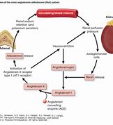 Image result for Pheochromocytoma Renin