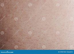 Image result for Human Skin Pores