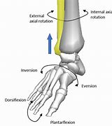 Image result for Deformity of Fibular Head