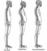 Image result for Posture Posterior View