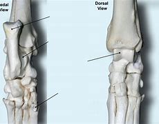 Image result for Dorsal Pedal Artery Anatomy