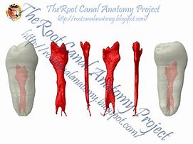 Image result for Mandibular 1st Premolar