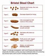 Image result for White Stool Chart