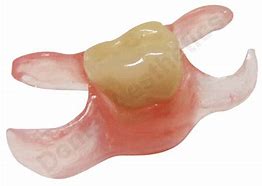 Image result for Valplast Partial One Tooth