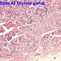 Image result for Parafollicular Cells Histology