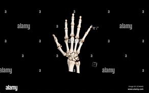 Image result for Normal Hand Radiograph