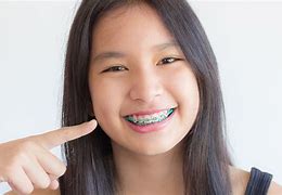 Image result for Kids Orthodontics