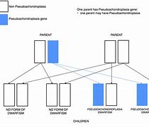 Image result for Pseudo Dwarfism