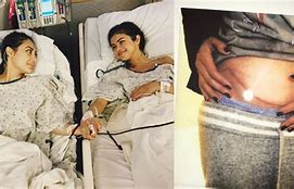 Image result for Selena Gomez with Lupus