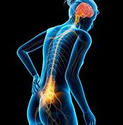 Image result for Spinal Neck Pain