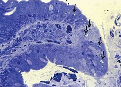 Image result for Intestinal Protozoa