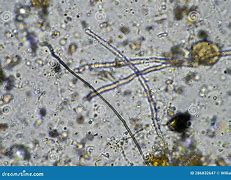 Image result for Fungal Hyphae in Soil