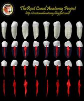 Image result for Mandibular 1st Premolar