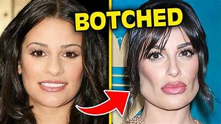 Image result for botched plastic surgery eyes