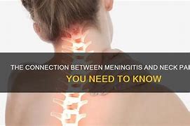 Image result for Meningitis Neck Pain