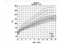 Image result for Achondroplasia Height Chart