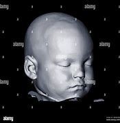 Image result for CT Baby Scan 3D