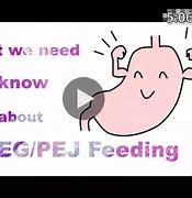 Image result for Combined Peg Pej