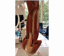 Image result for Brachial Plexus Posterior View