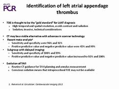 Image result for Left Atrial Appendage Thrombus On Toe