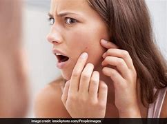 Image result for Swollen Face From Under the Skin Pimple