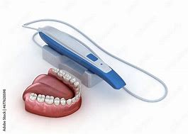 Image result for 3D Teeth Scanner