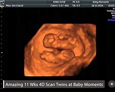 Image result for Mother 4D Baby Scan