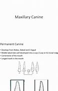 Image result for Maxillary Canine Pulp