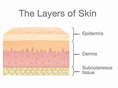 Image result for Dermis Skin Cut