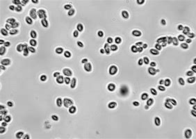 Image result for Dry Saccharomyces Cerevisiae