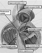 Image result for Interatrial Septum Formation