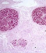 Image result for Mycobacterium in Fish